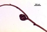 9 - Cistocarpo